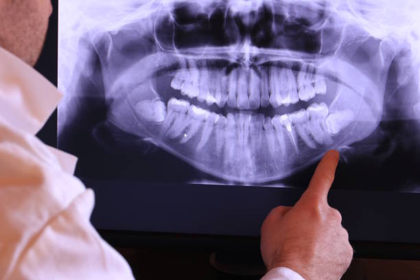 Best Dental Abscess Treatment in Gretna, FL